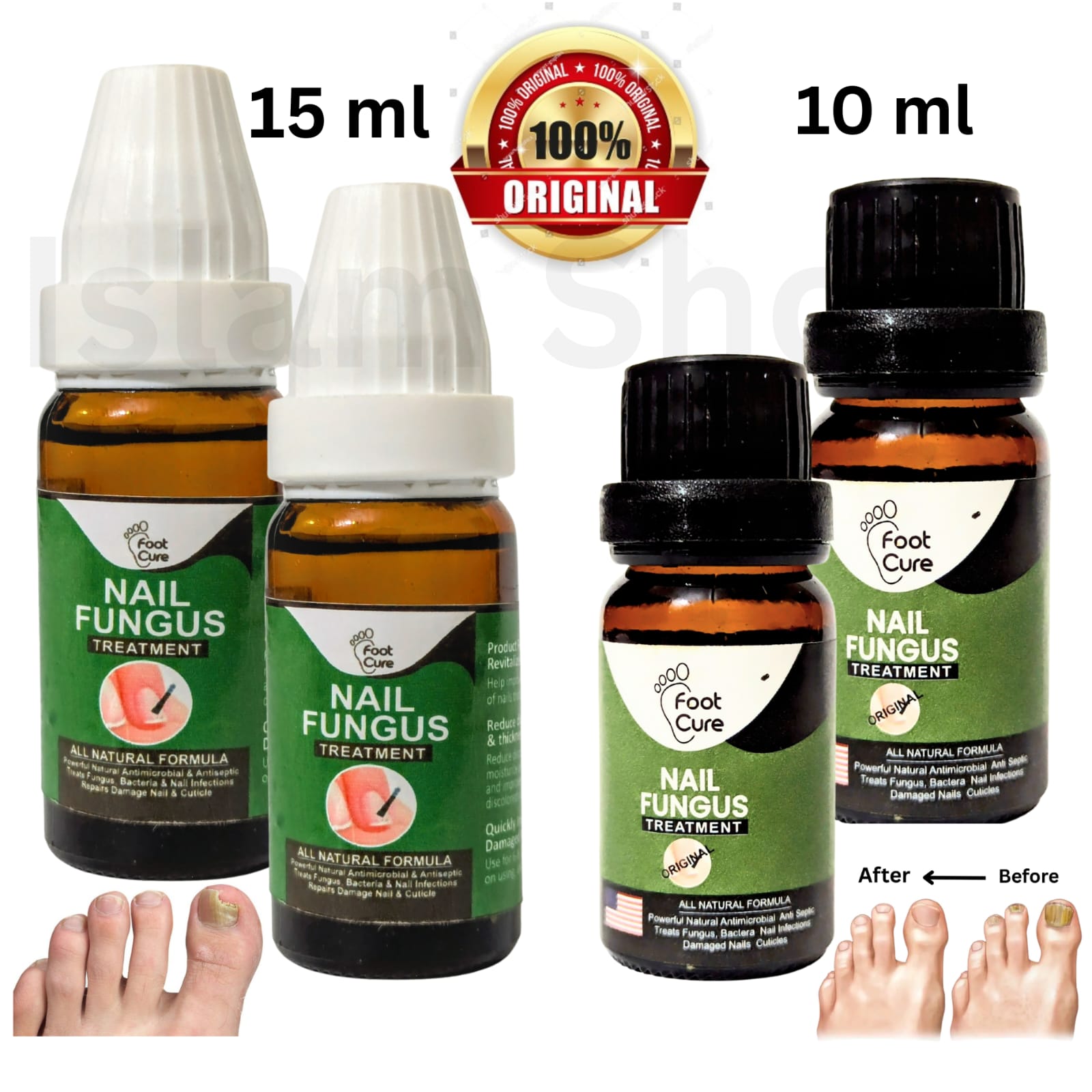Fast nail repair essences serum care_ Nail Fungal Treatments_Nail Repair Essences Serum Care Treatments Foot Nail Fungus Removal Gel Paronychia Onychomycosis Nail Fungus Solution Fungus Removers Nail Strengthener Nail Fungus's Solution For Thick Nails