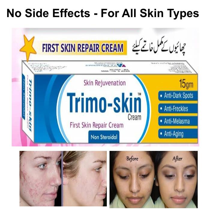 kojic cream for acne scars