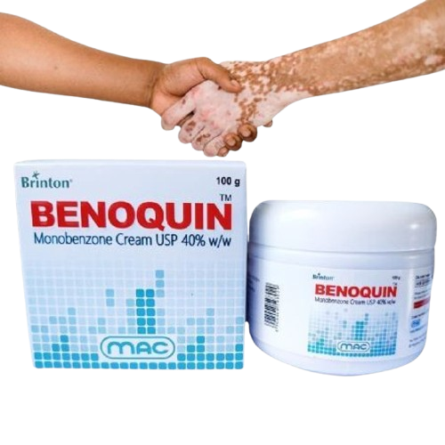Benoquin Monobenzone Cream New In Pakistan | Daraz.pk