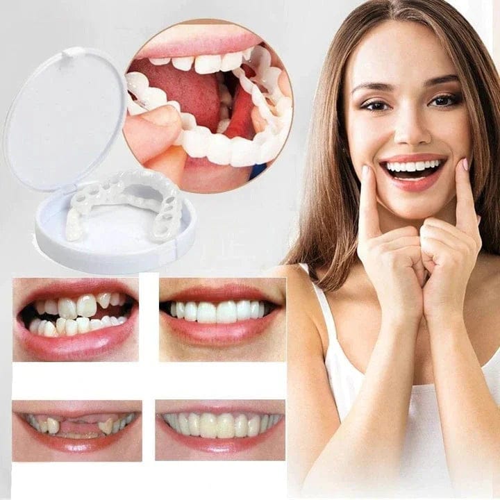 Snap-On Veneers for Teeth Whitening – Instant Perfect Smile, Cosmetic Denture Cover,Teeth Cover, Fake Tooth Cap for Oral Hygiene & Confidence Boost