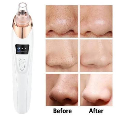 5-in-1 Electric Blackhead Remover Vacuum Suction Face Pore Cleaner Machine | Acne, Whitehead & Blackhead Removal Tool | Deep Pore Cleansing Oil Remover | USB Rechargeable Facial Skin Care Device