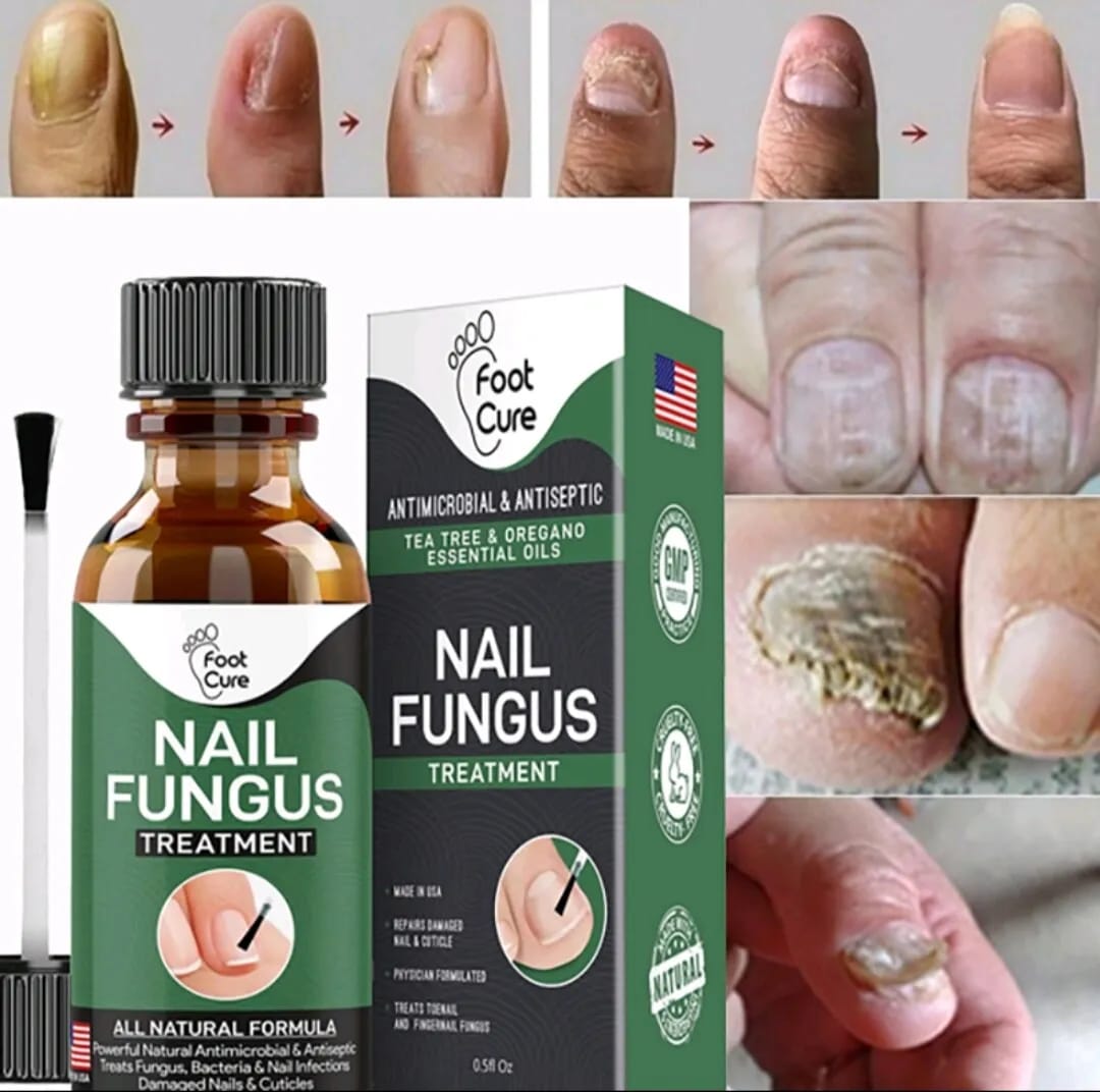 Fast Nail Fungal Treatments Nail Repair Essences Serum Care Treatments Foot Nail Fungus Removal Gel Paronychia Onychomycosis