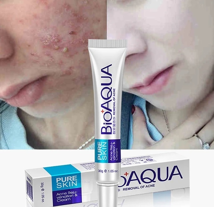 aqua acne cream