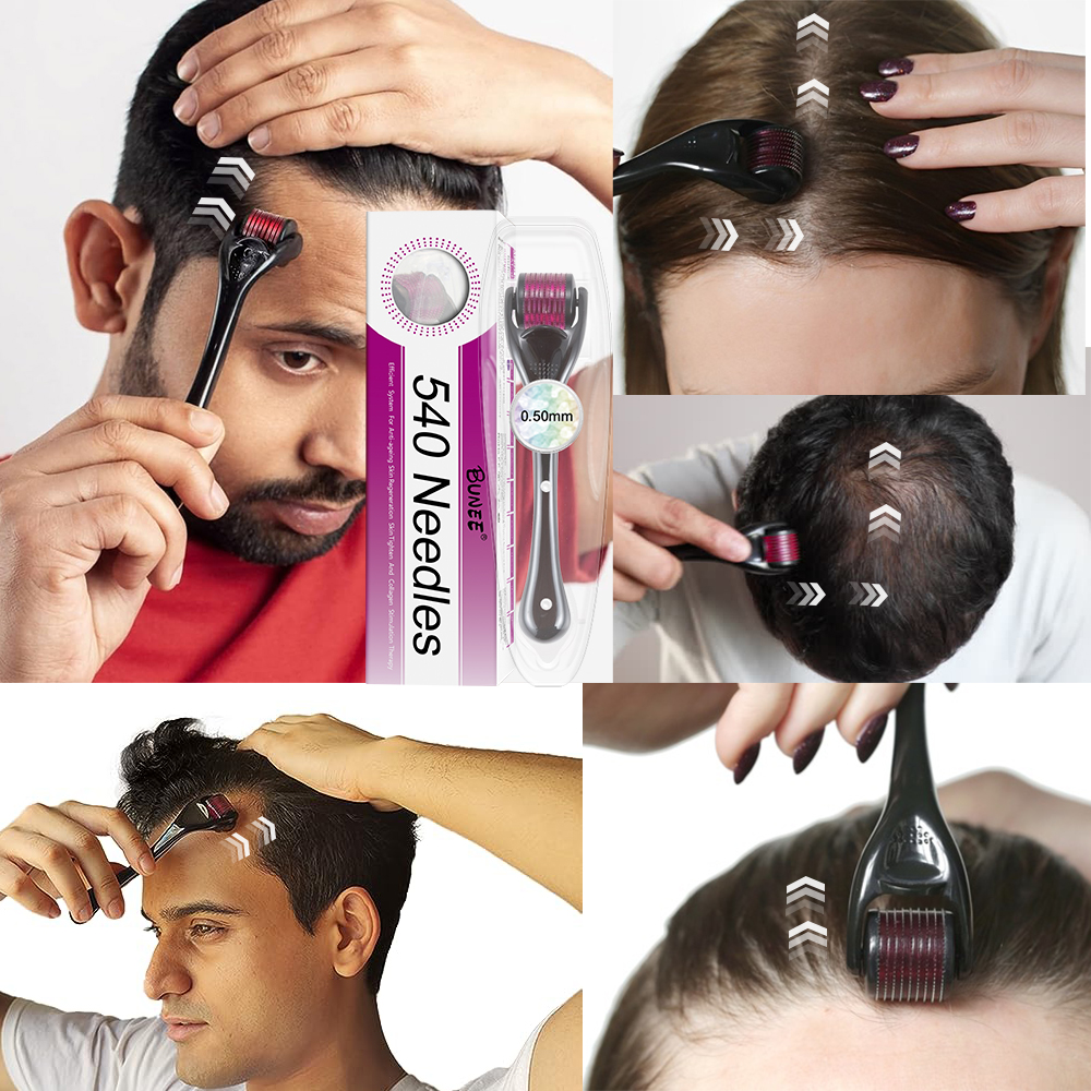 7 Days Hair Growth serum with Derma Roller With 540 Micro Needle Skin Therapy 0.50mm  Natural Hair Treatment Effective Fast Growth Hair Care