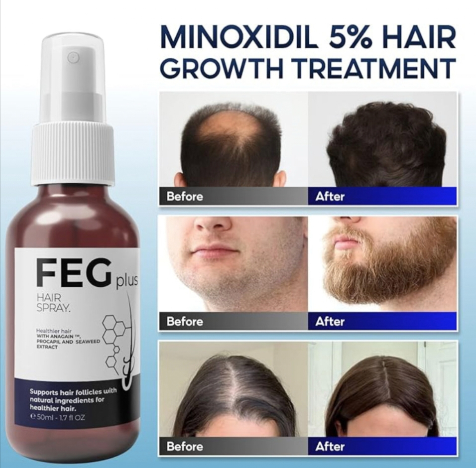 High Quality FEG Plus Beard & Hair Growth Serum Spray | Natural Hair Regrowth for Men | Beard Booster Serum | 50ml Hair Growth Spray | Beard Growth Serum | Natural Regrowth Solution