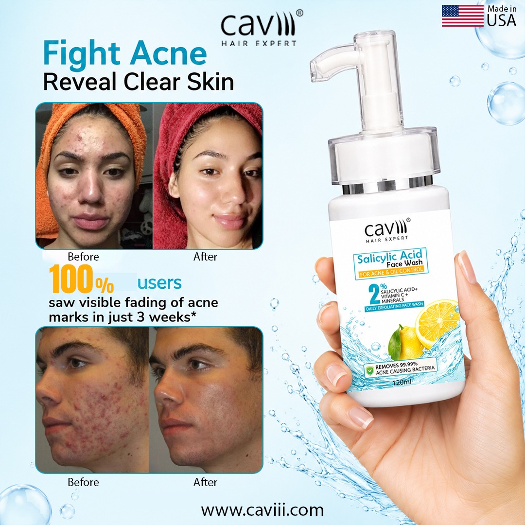 Caviii 2% salicylic acid face wash Imported USA Pharma 100% Results for acne scar & blemishes for men and women Daily face wash