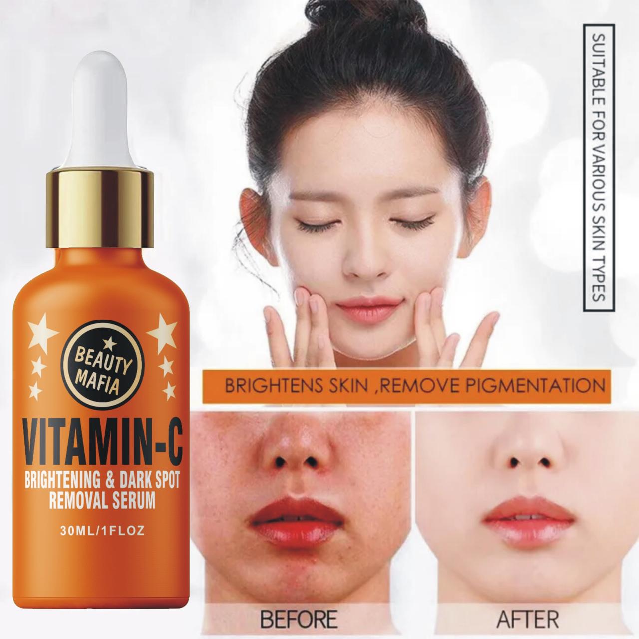 BEAUTY MAFIA Vitamin C Serum | Serum for Brightening Skin & Dark Spot Removal Serum | 30ml