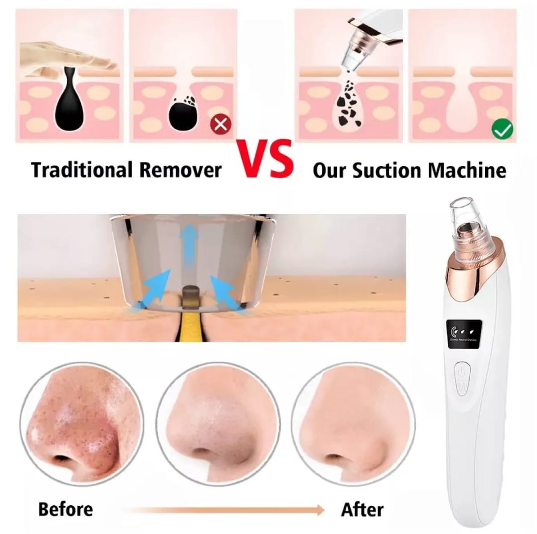 5 in 1 Multifunction Blackhead Removal Rechargeable Machine | White ...