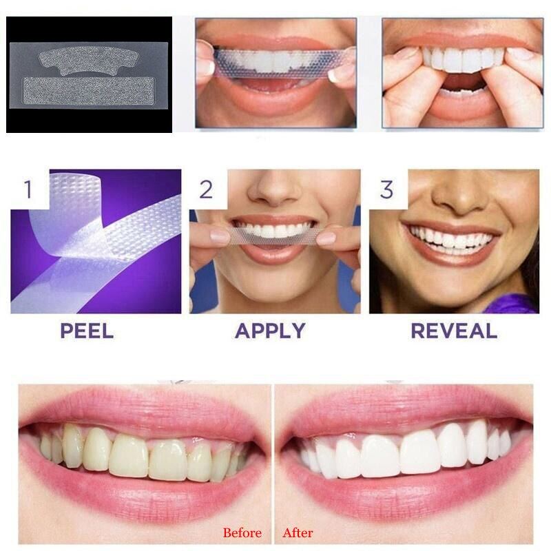 Professional Teeth Whitening Strips – Oral Hygiene