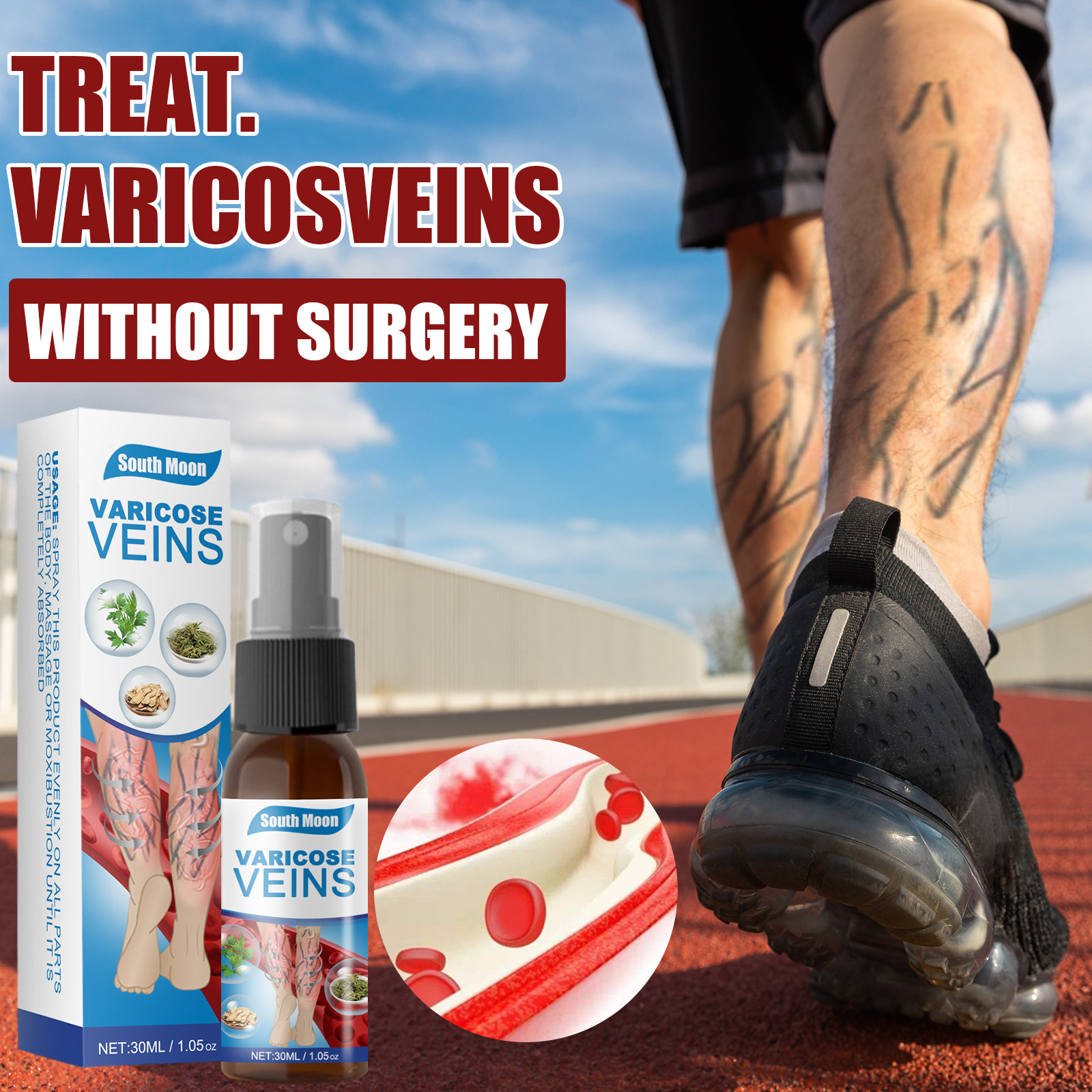 Varicose Vein Relief Spray, 30ml - Herbal Treatment for Blood Vessel  Smoothness & Circulation Enhancement | Daraz.pk