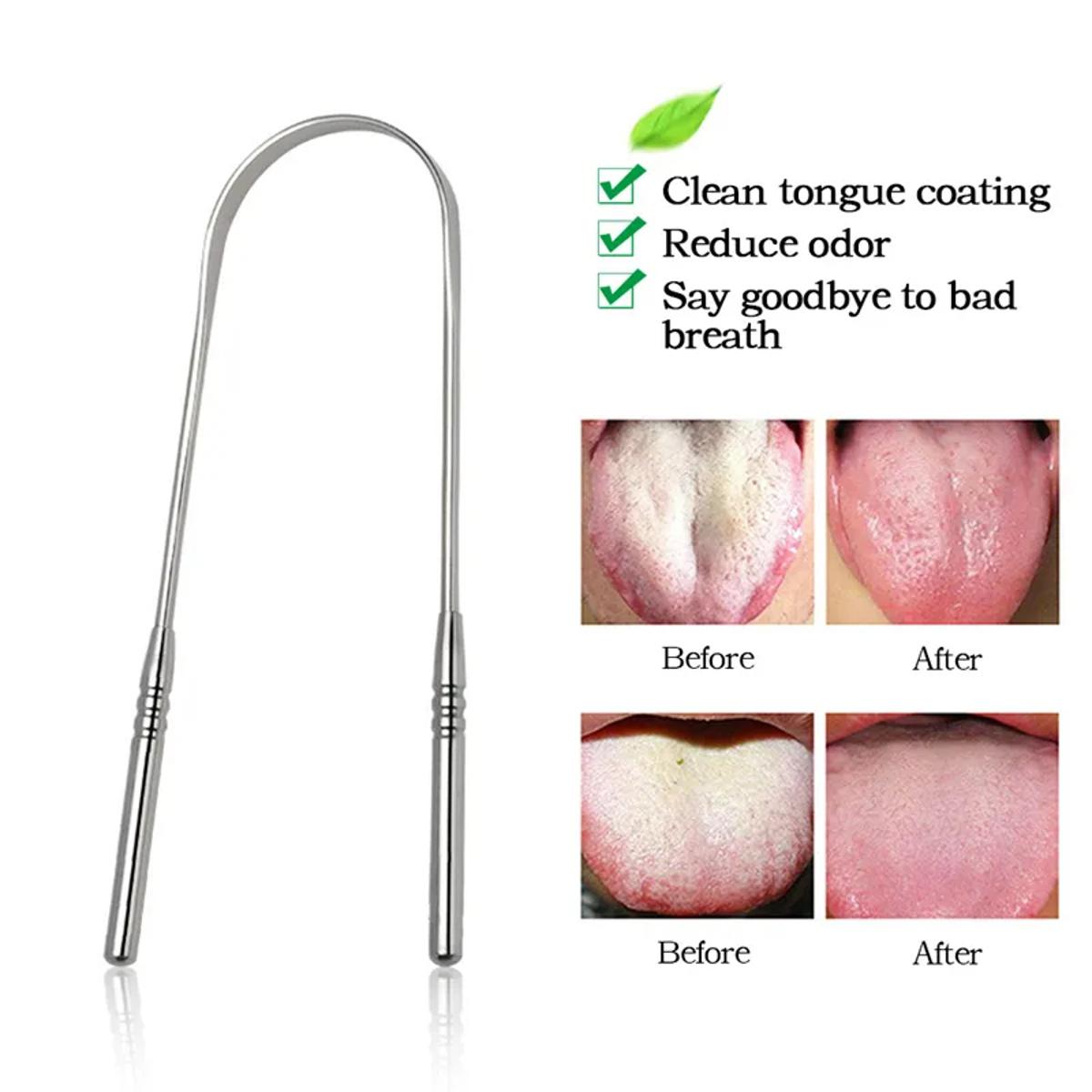Stainless Steel Tongue Scraper 1 Pcs - Ultimate Oral Care Tool for Bad Breath Removal