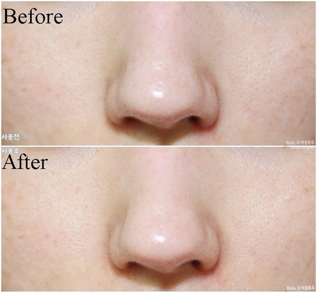 super volcanic pore micellar cleansing foam