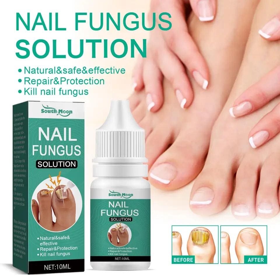 🧴 Fast Nail Fungal Treatment Oil & Gel – Anti-Fungal Nail Repair Serum for Onychomycosis, Paronychia, Cracked & Discolored Toenails | Foot & Hand Care | Herbal Essence | Rapid Fungus Removal | Nail Strengthening | Daily Use | For Men & Women