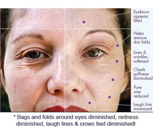 dermawand skin care