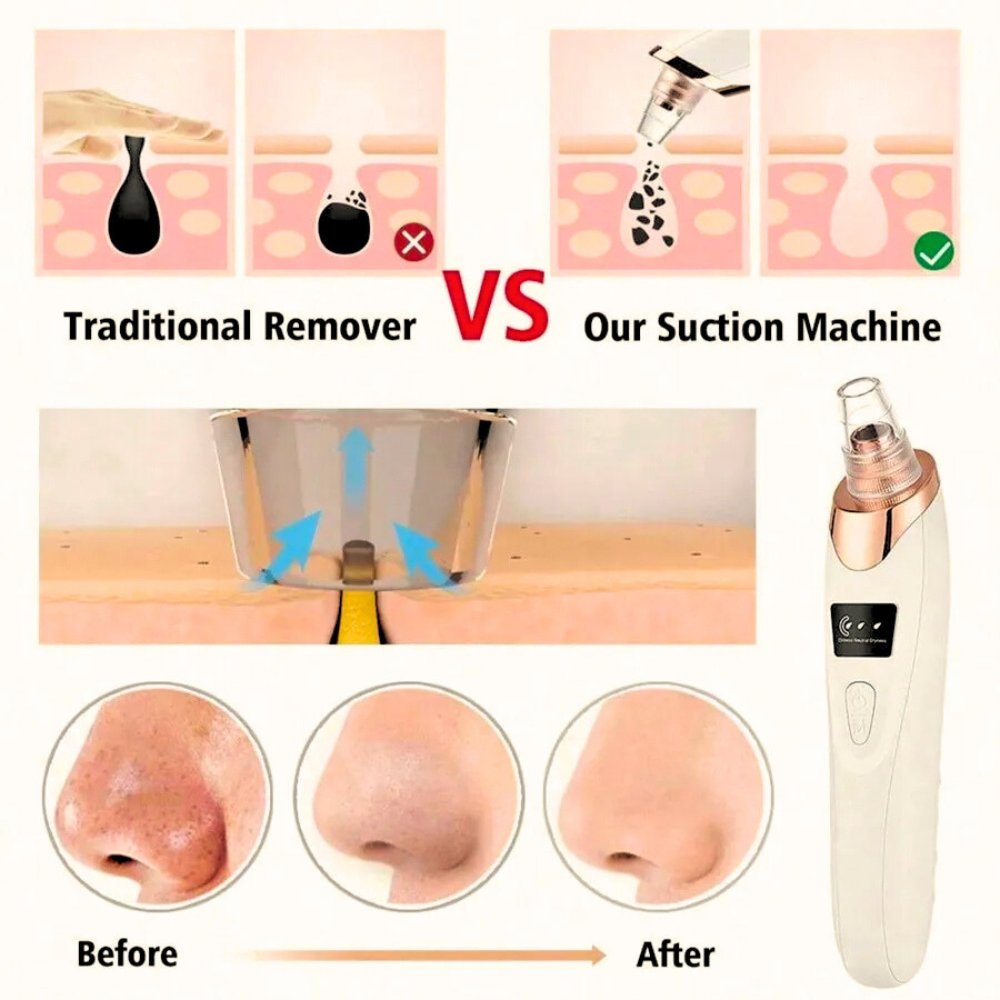 5-in-1 Derma Suction Blackhead Remover Machine | Pore Vacuum Cleaner | Acne Pimple Extractor | Facial Pore Suction Tool | Deep Face Cleaning | Whitehead & Blackhead Removal | Rechargeable Skin Care  Multi-Functional Skin Care Beauty Tool for Nose  & Face