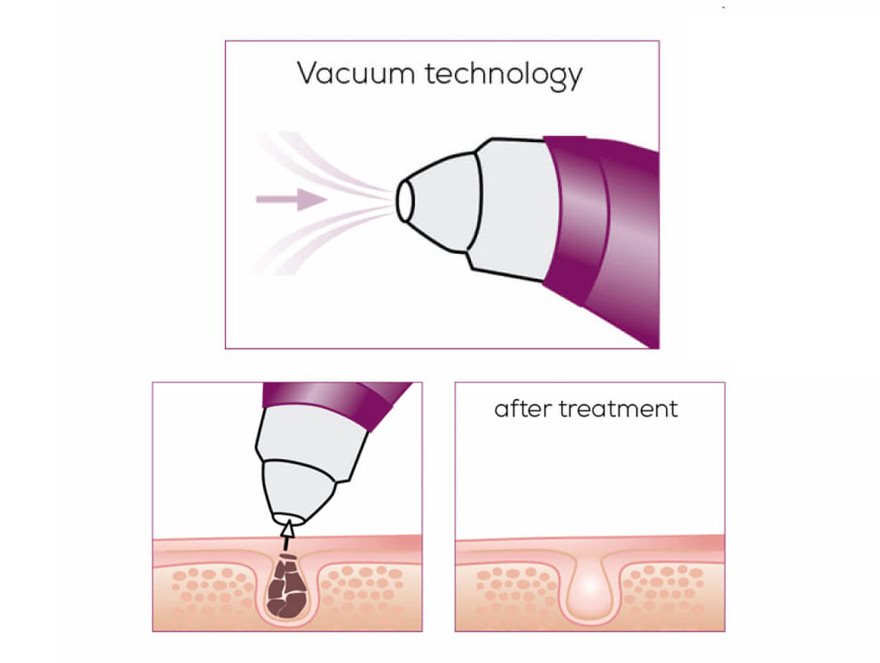 power deep pore cleanser